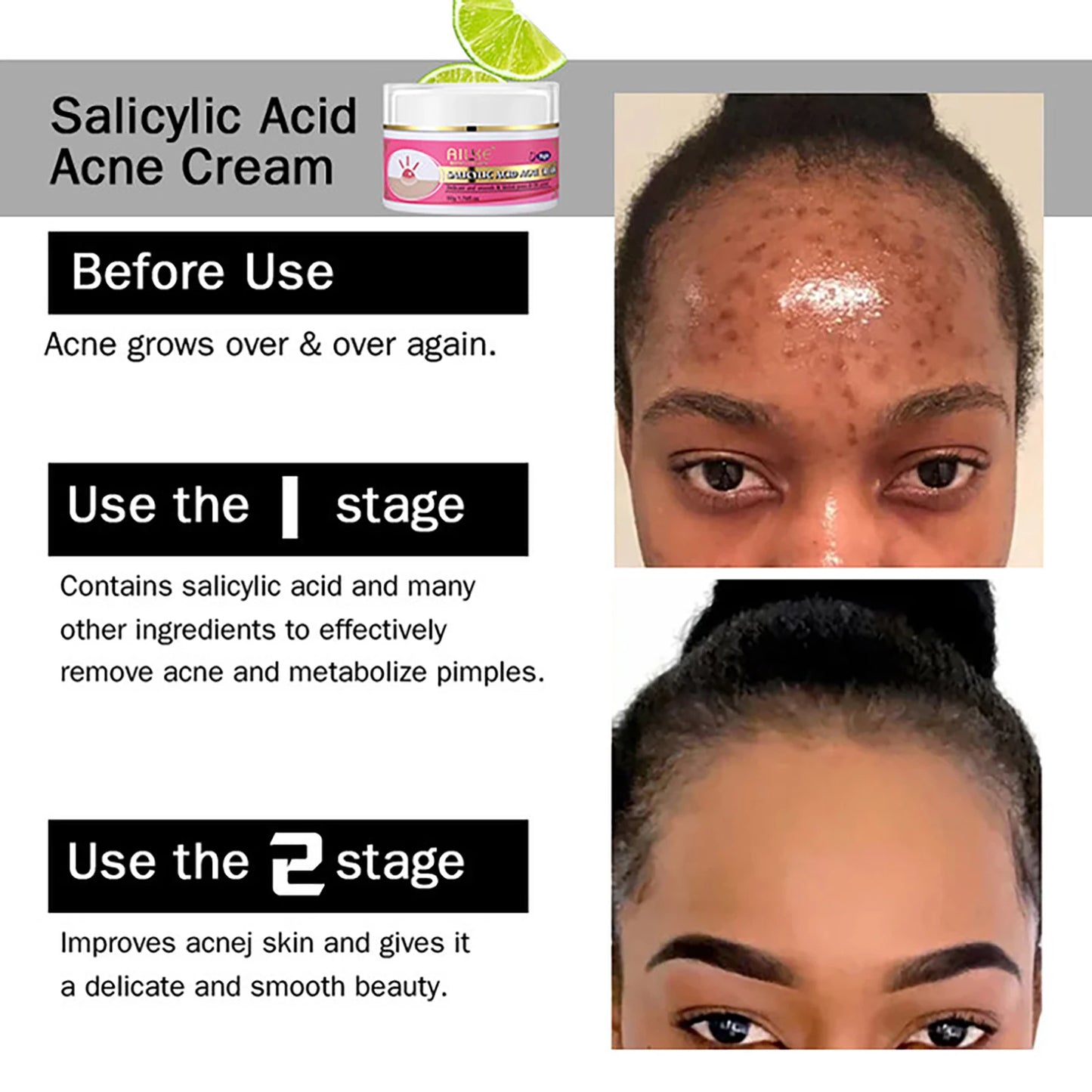 AILKE Skin Glowing Set With Niacinamide Moisturizing Brightening Cream