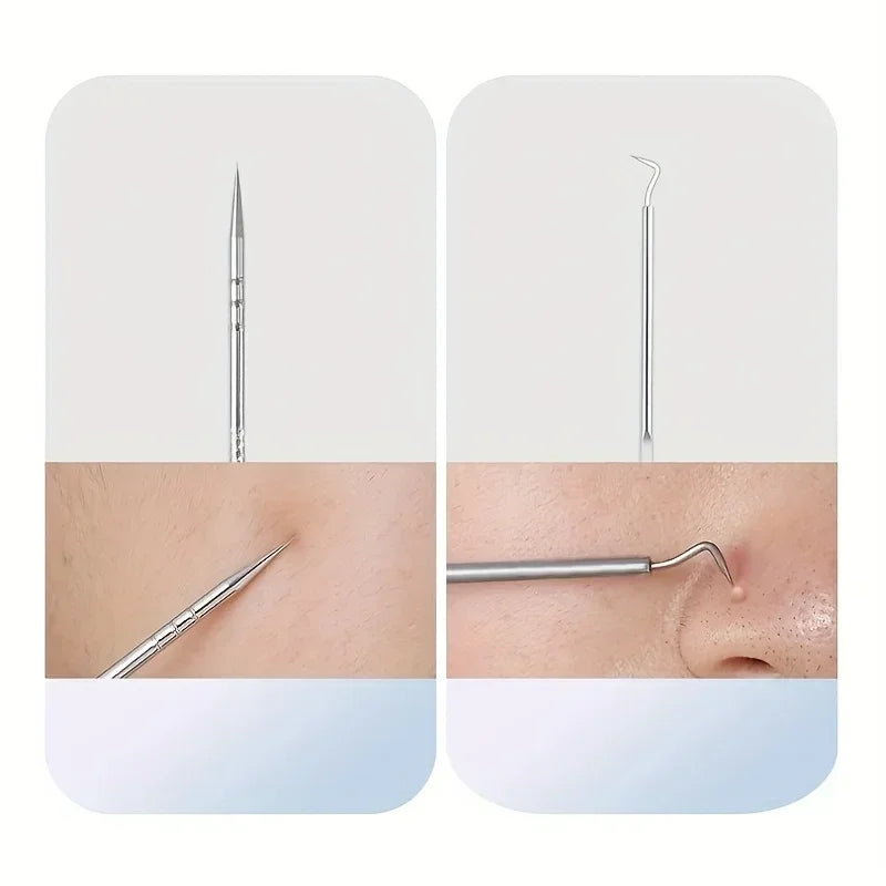 Stainless Steel Skin Care Tool Set Blackhead Pimple Removal Kit