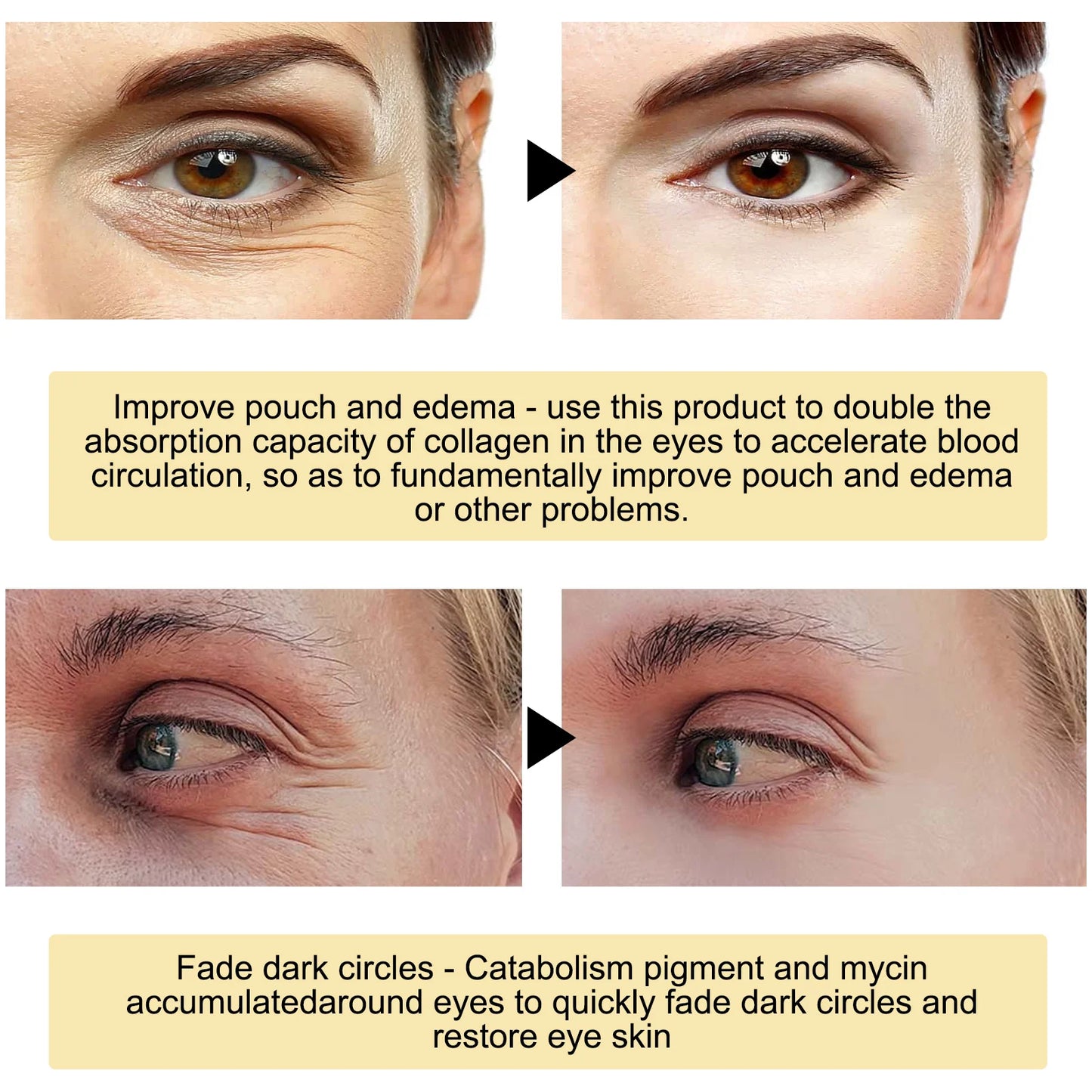 Eelhoe 24K Gold Under Eye Patches Anti Aging Moisturizing Firming