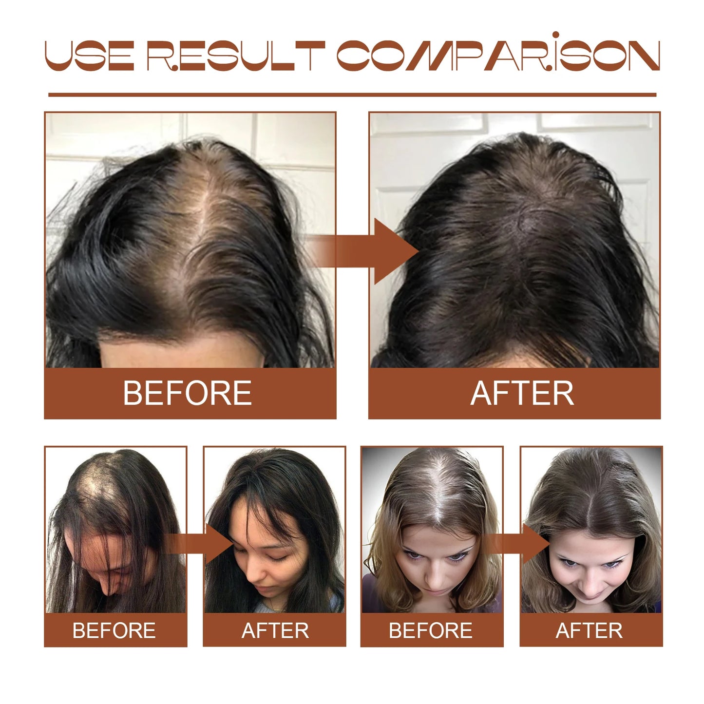 Eelhoe Batana Oil Hair Conditioner For Smoothing And Shine