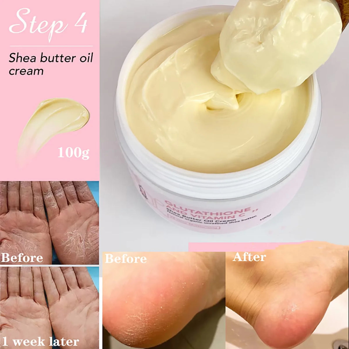 AILKE Whitening And Lightening Face And Body Cream