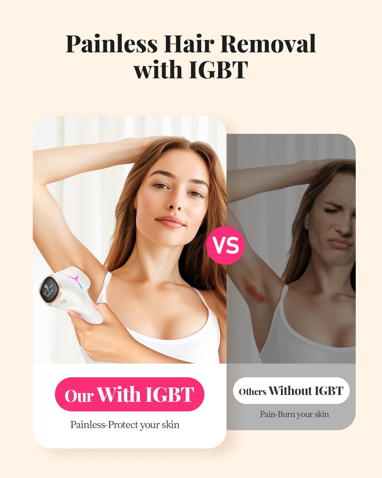 Totmizby IPL Hair Removal Device For Face Body 990000 Flashes