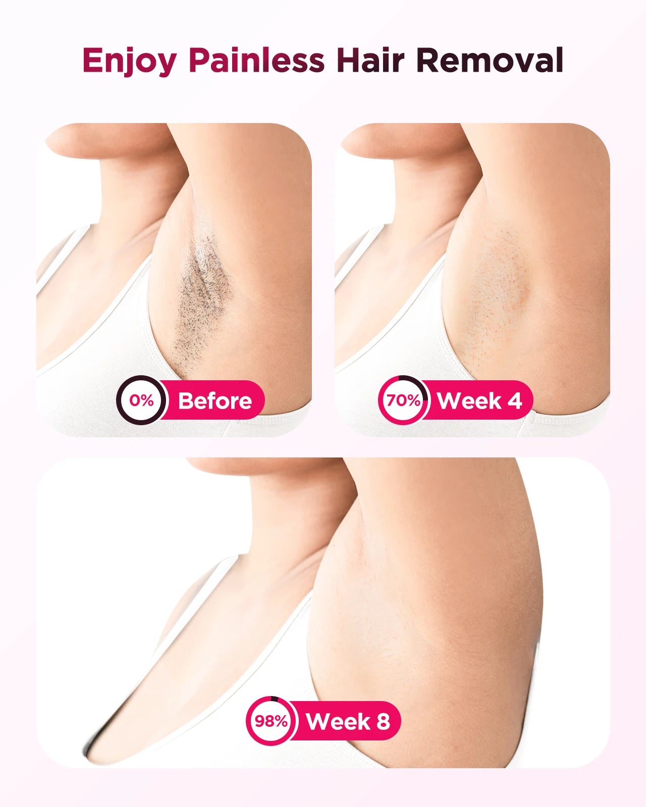 Totmizby Painless Ipl Laser Hair Removal Epilator With Trimmer